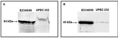 Genetic and Virulence Characteristics of a Hybrid Atypical Enteropathogenic and Uropathogenic Escherichia coli (aEPEC/UPEC) Strain